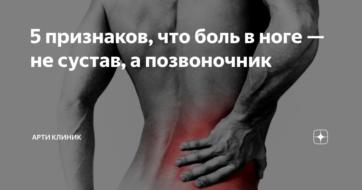 5 признаков, что боль в ноге — не сустав, а позвоночник