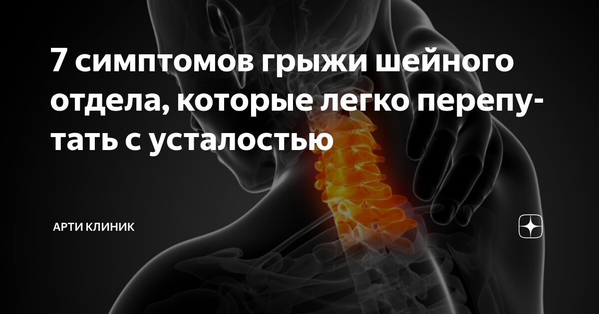 7 симптомов грыжи шейного отдела, которые легко перепутать с усталостью