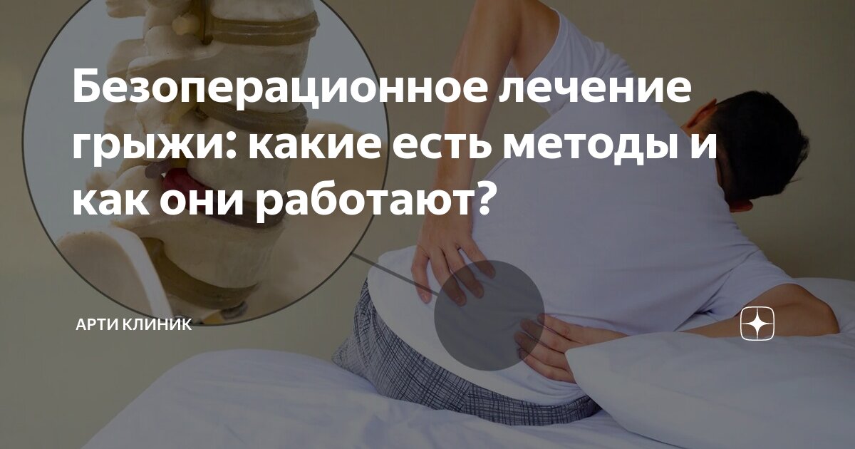 Безоперационное лечение грыжи: какие есть методы и как они работают?