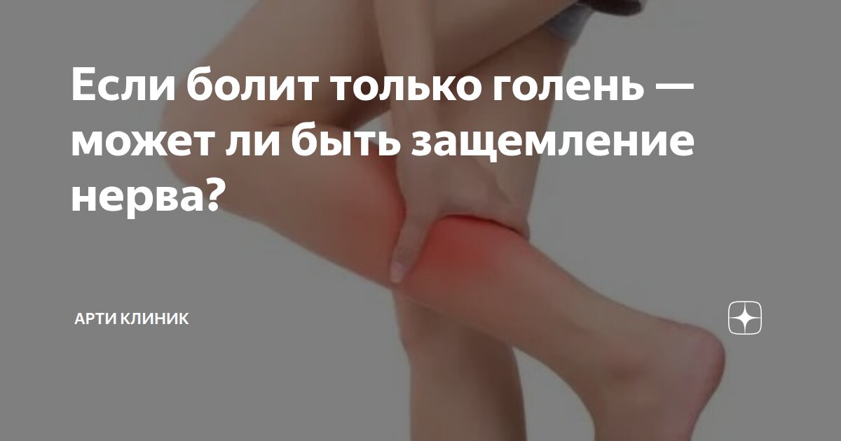 Если болит только голень — может ли быть защемление нерва?