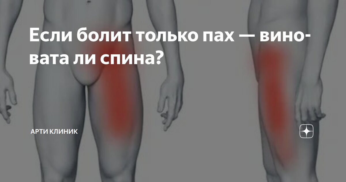 Если болит только пах — виновата ли спина?