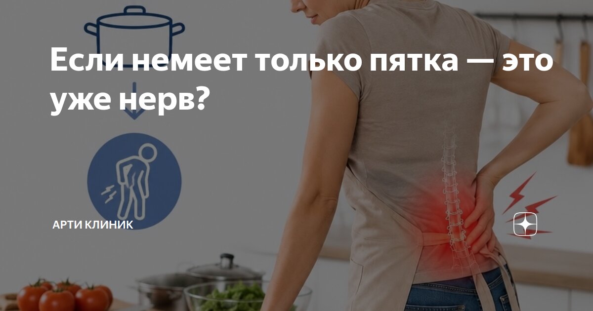Если немеет только пятка — это уже нерв?
