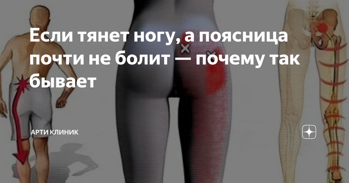 Если тянет ногу, а поясница почти не болит — почему так бывает