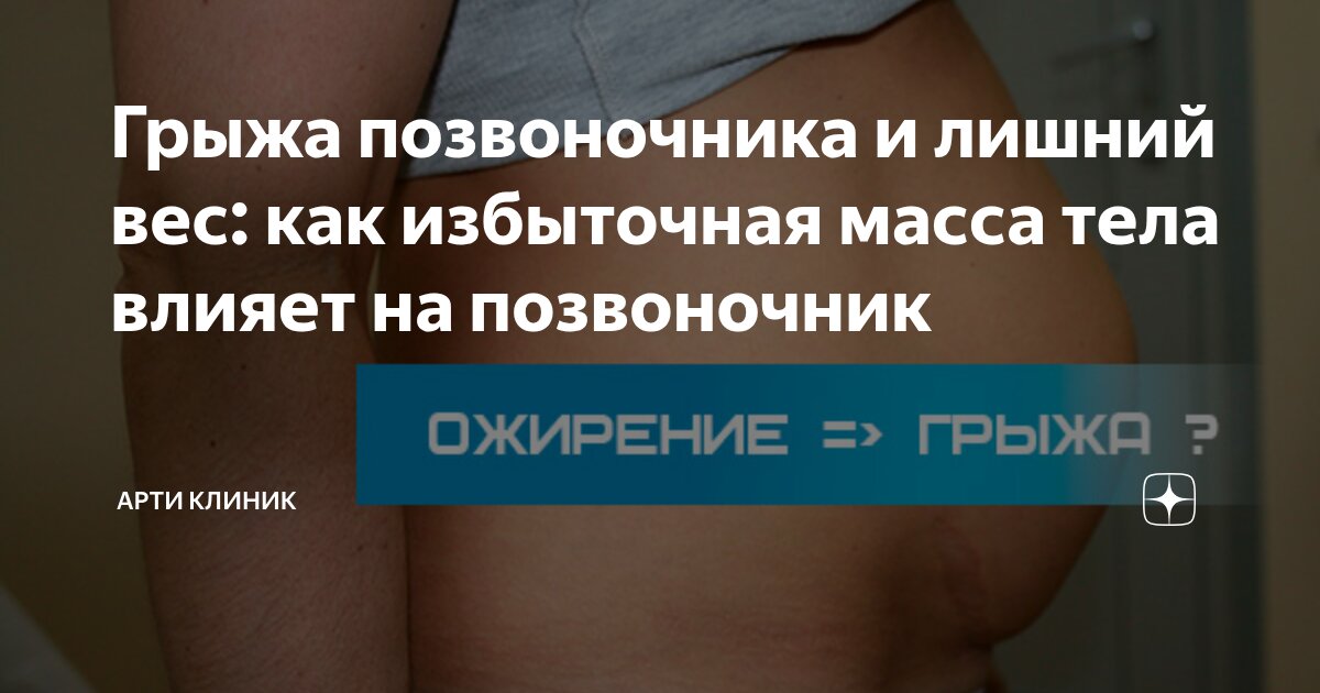 Грыжа позвоночника и лишний вес: как избыточная масса тела влияет на позвоночник