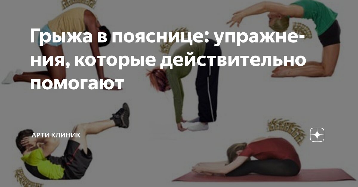 Грыжа в пояснице: упражнения, которые действительно помогают
