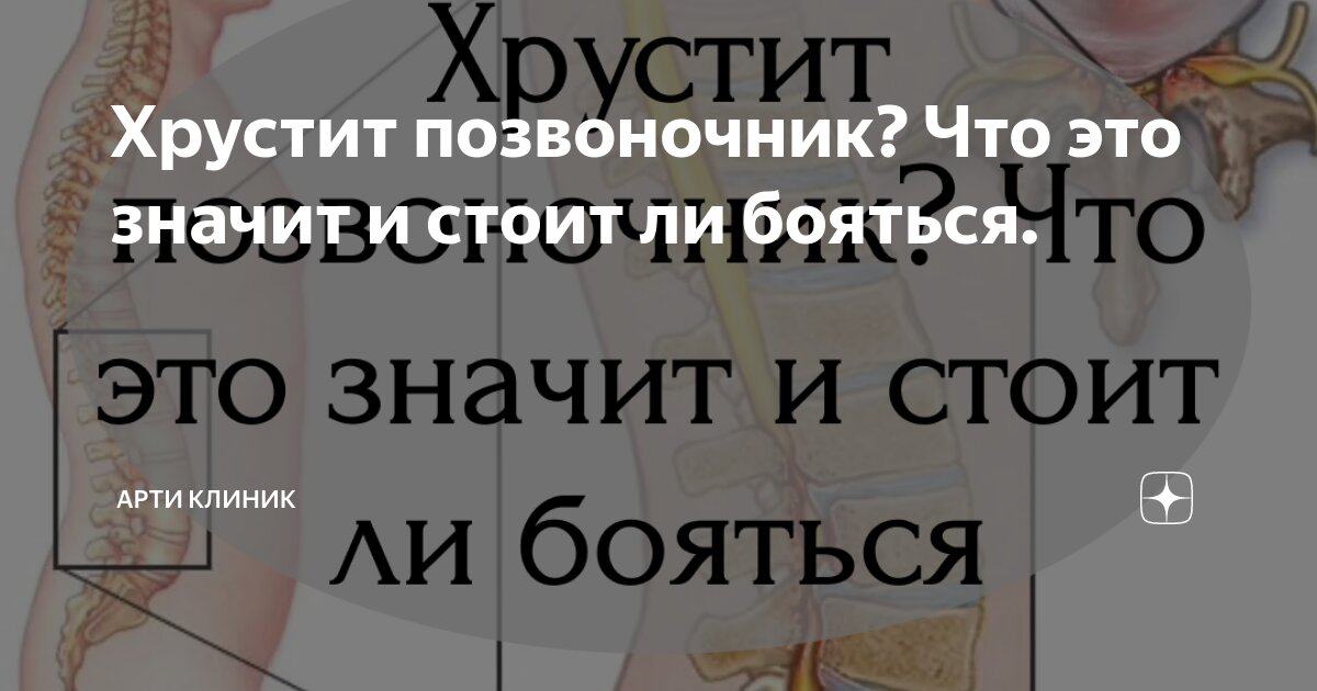 Хрустит позвоночник? Что это значит и стоит ли бояться.