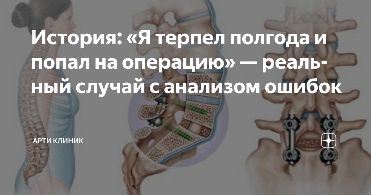 История: «Я терпел полгода и попал на операцию» — реальный случай с анализом ошибок