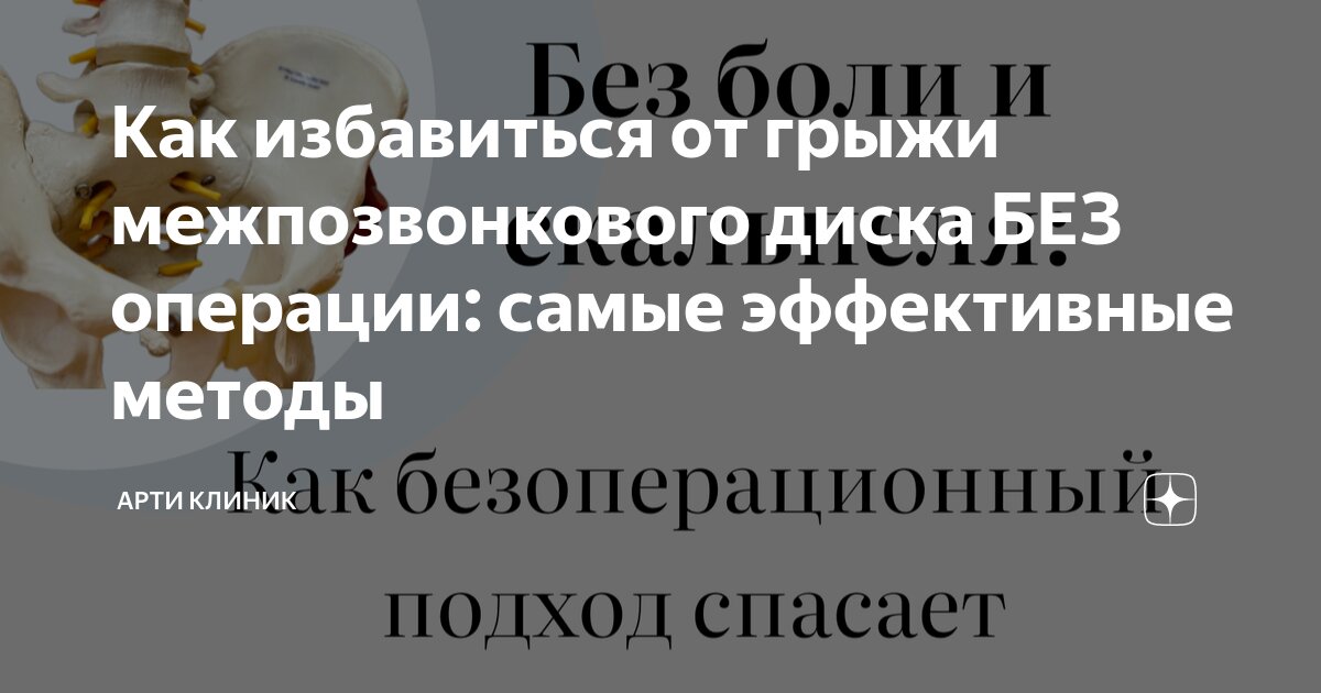 Как избавиться от грыжи межпозвонкового диска БЕЗ операции: самые эффективные методы