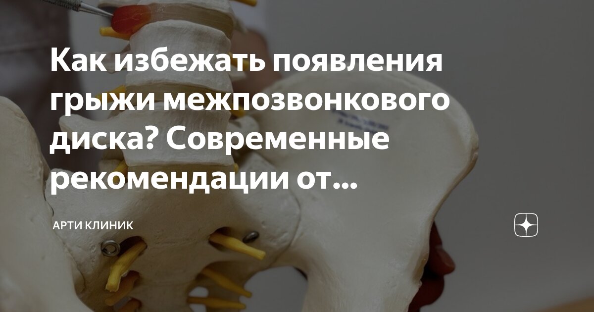 Как избежать появления грыжи межпозвонкового диска? Современные рекомендации от спецаилистов Арти Клиник