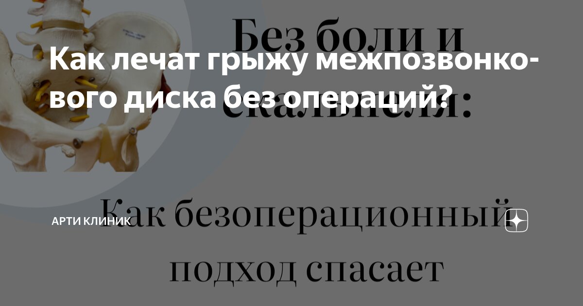 Как лечат грыжу межпозвонкового диска без операций?
