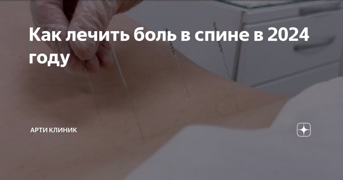 Как лечить боль в спине в 2024 году