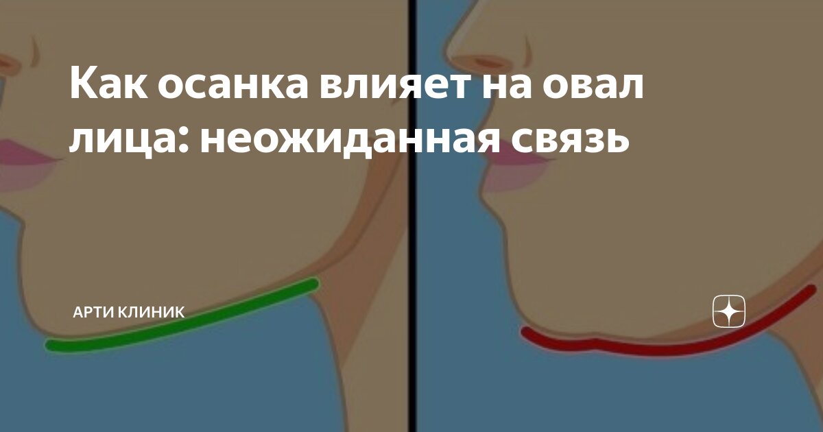 Как осанка влияет на овал лица: неожиданная связь
