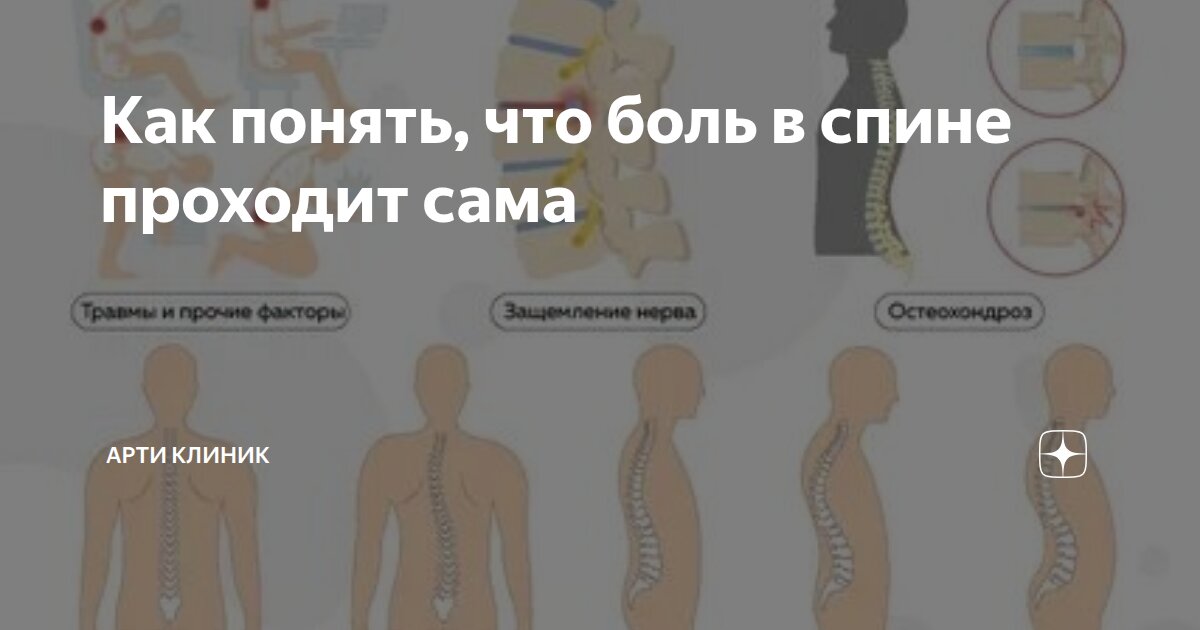Как понять, что боль в спине проходит сама