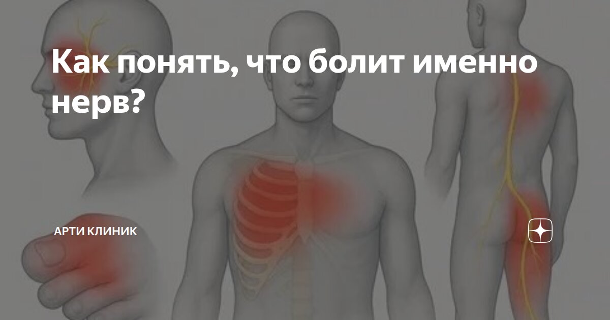 Как понять, что болит именно нерв?