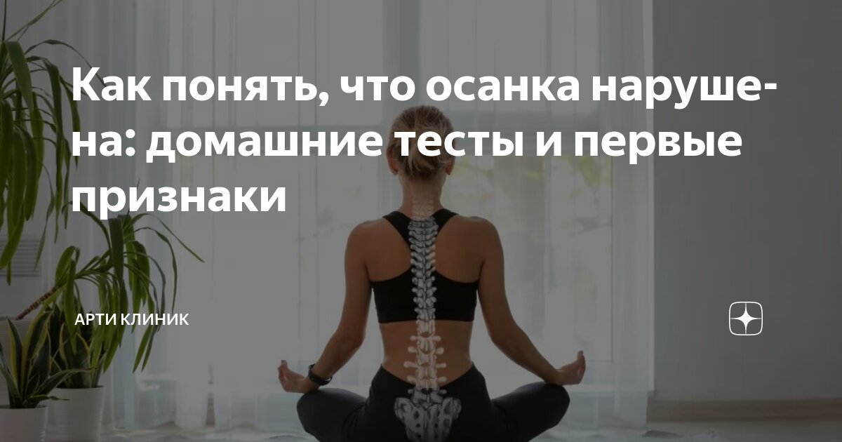 Как понять, что осанка нарушена: домашние тесты и первые признаки