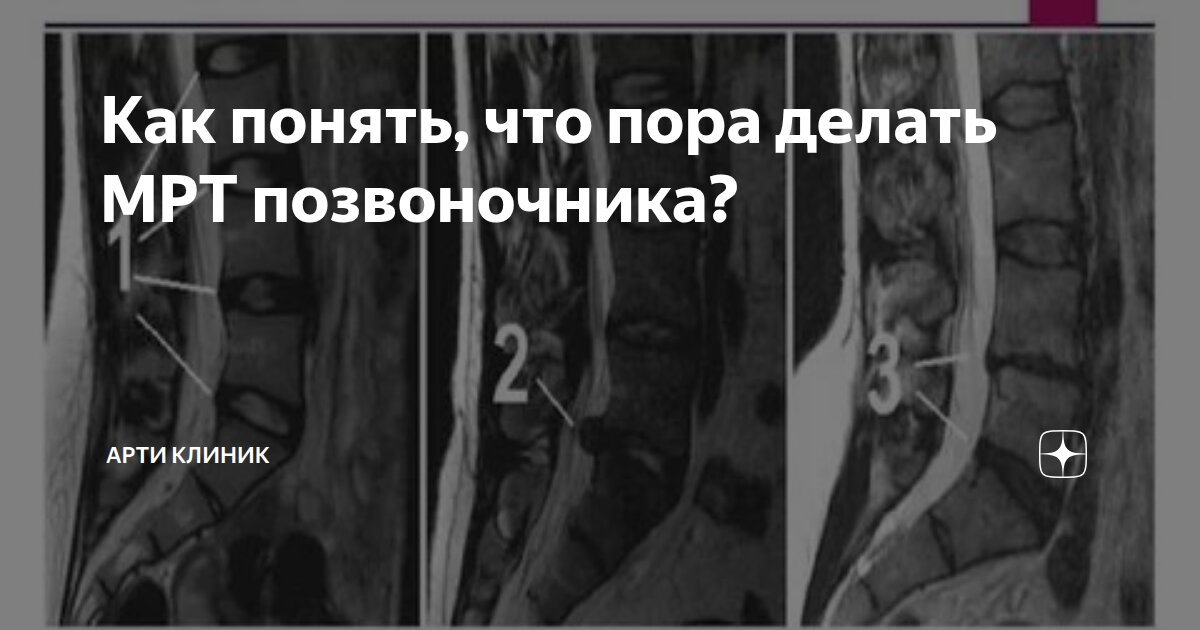 Как понять, что пора делать МРТ позвоночника?