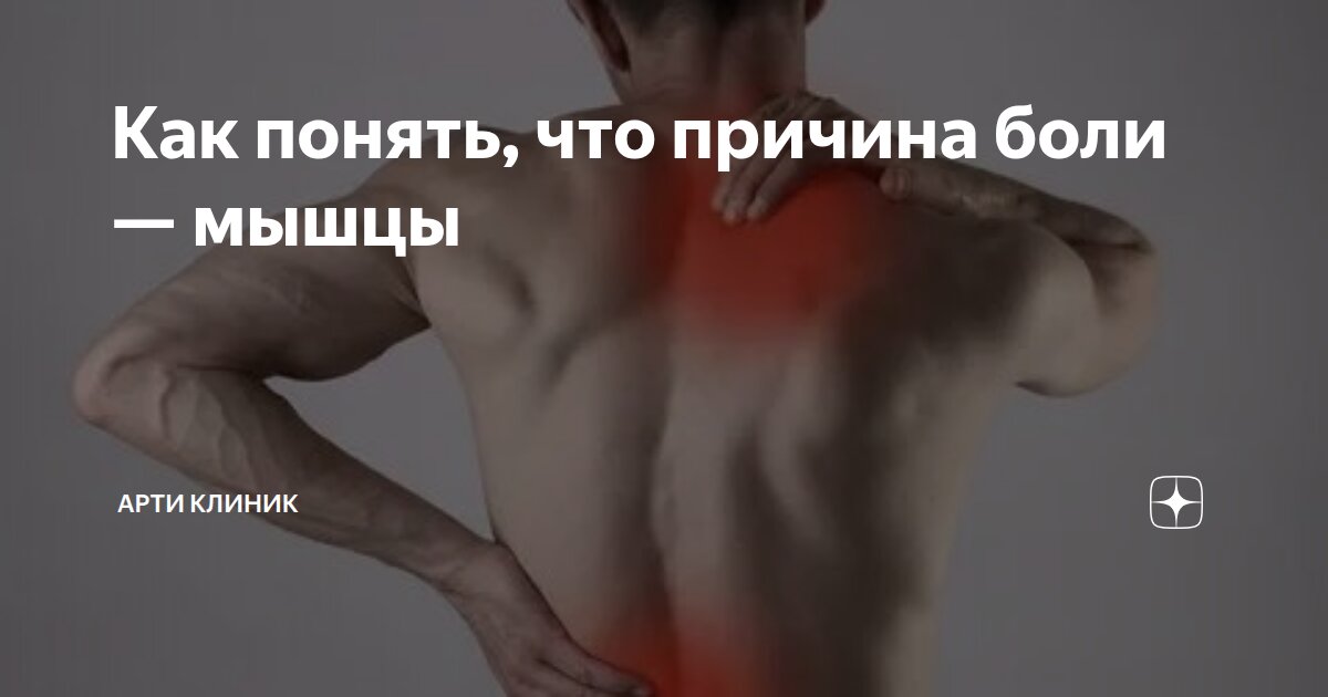 Как понять, что причина боли — мышцы