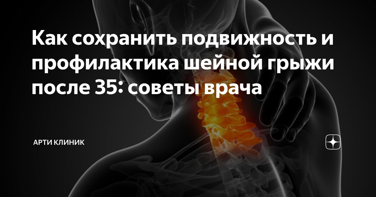 Как сохранить подвижность и профилактика шейной грыжи после 35: советы врача