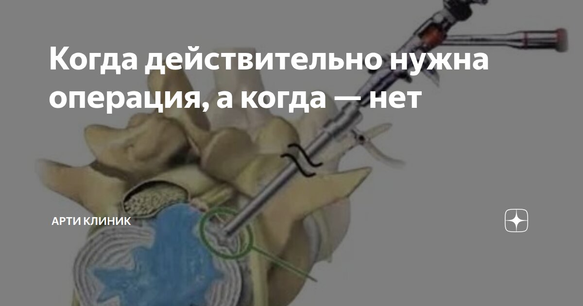 Когда действительно нужна операция, а когда — нет