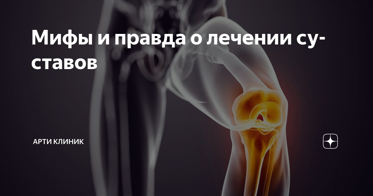 Мифы и правда о лечении суставов