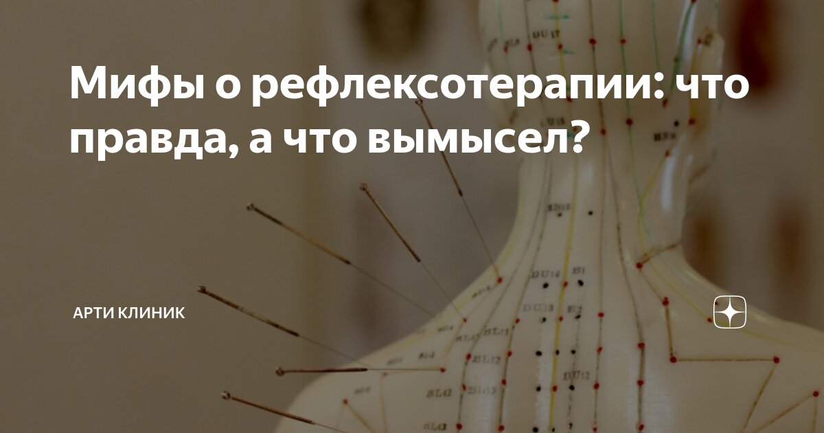 Мифы о рефлексотерапии: что правда, а что вымысел?