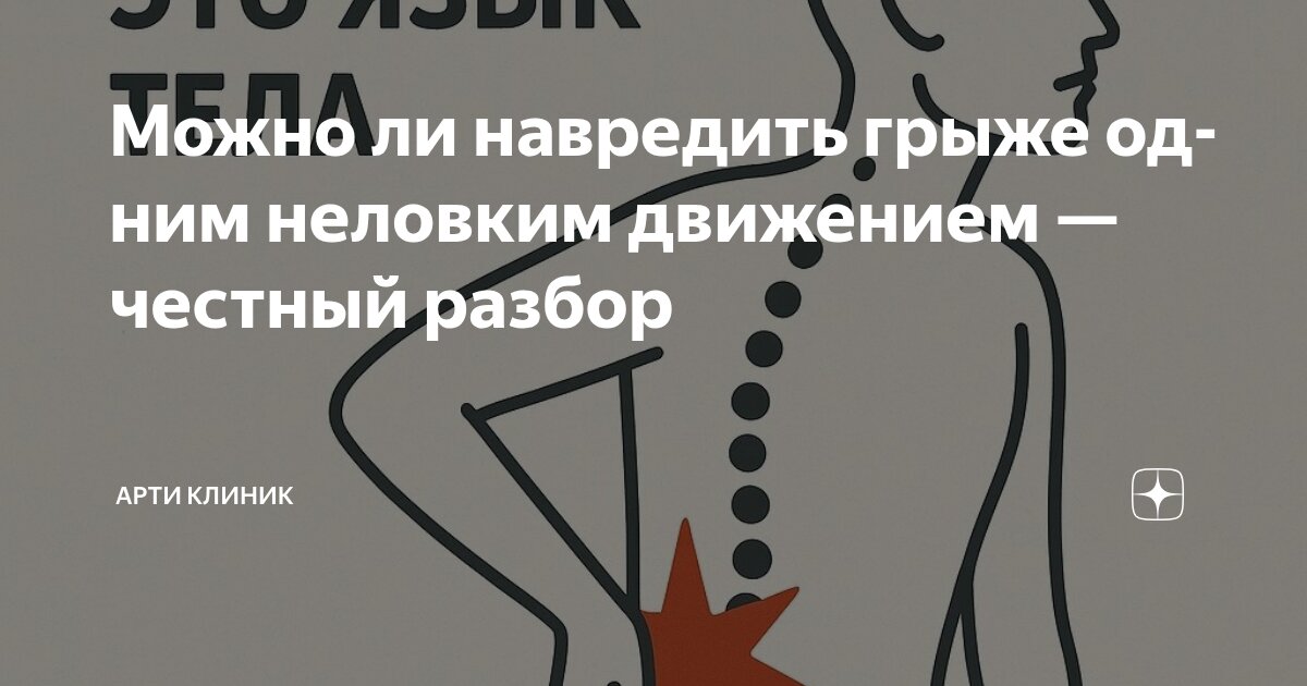 Можно ли навредить грыже одним неловким движением — честный разбор