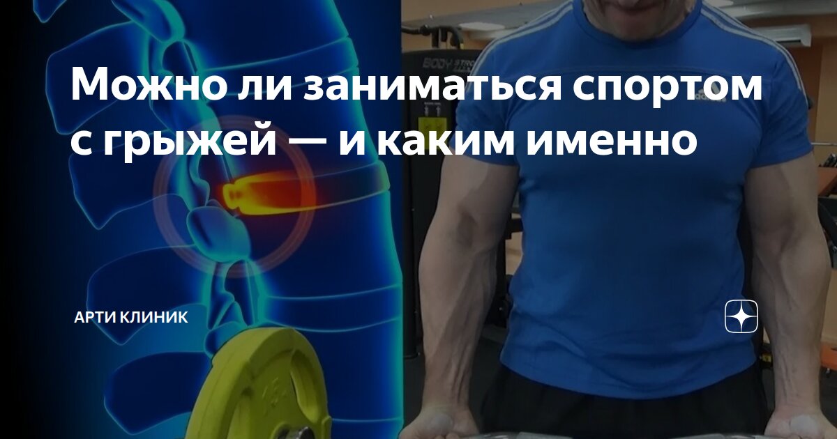 Можно ли заниматься спортом с грыжей — и каким именно