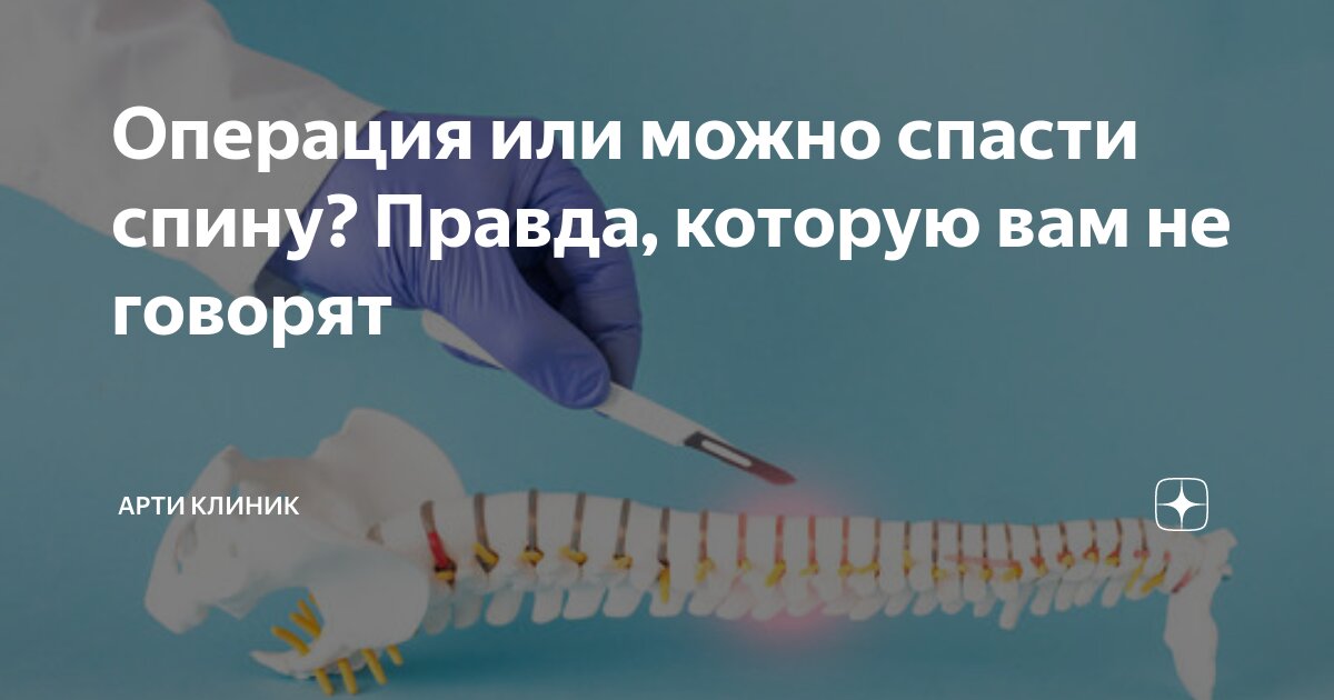 Операция или можно спасти спину? Правда, которую вам не говорят