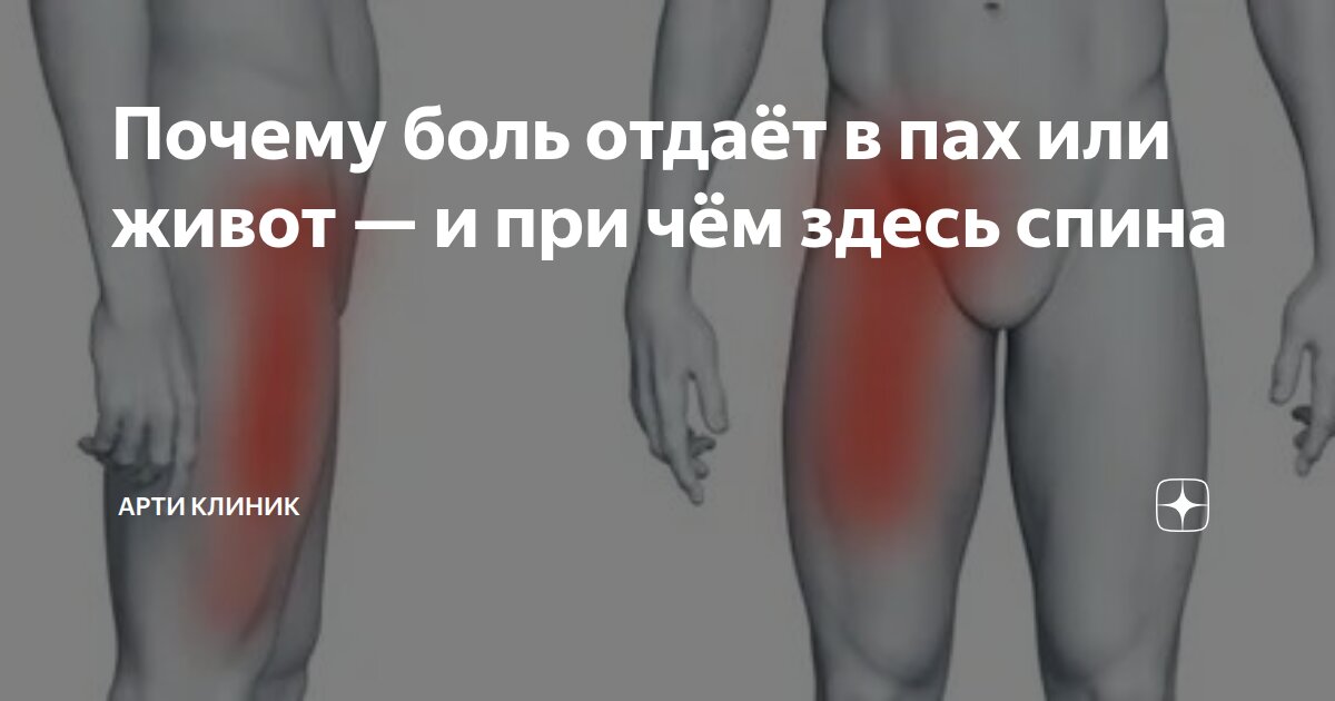 Почему боль отдаёт в пах или живот — и при чём здесь спина