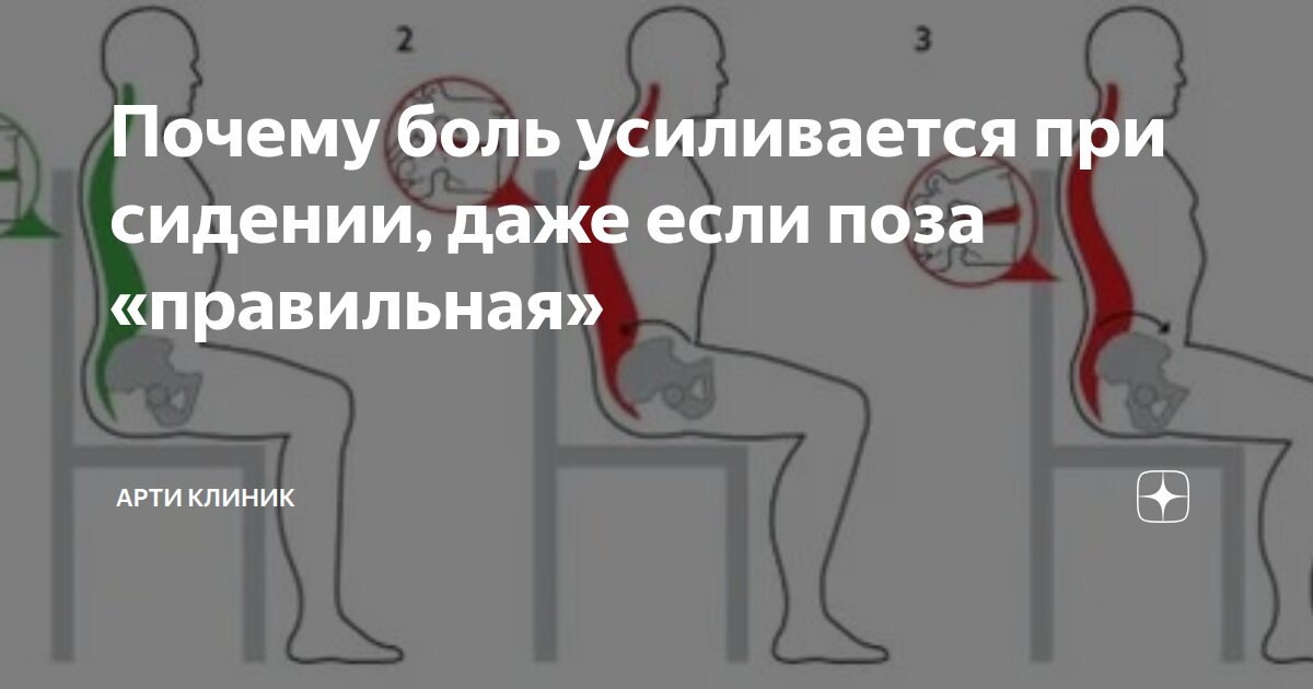 Почему боль усиливается при сидении, даже если поза «правильная»