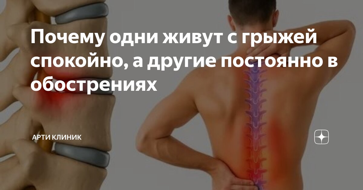 Почему одни живут с грыжей спокойно, а другие постоянно в обострениях