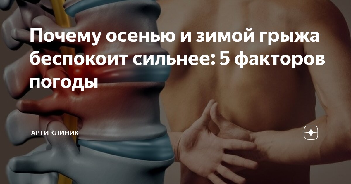 Почему осенью и зимой грыжа беспокоит сильнее: 5 факторов погоды