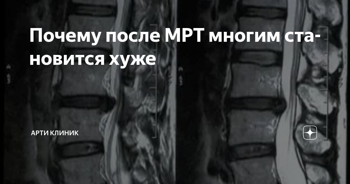 Почему после МРТ многим становится хуже