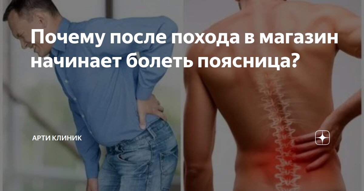 Почему после похода в магазин начинает болеть поясница?