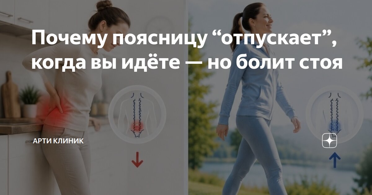 Почему поясницу “отпускает”, когда вы идёте — но болит стоя