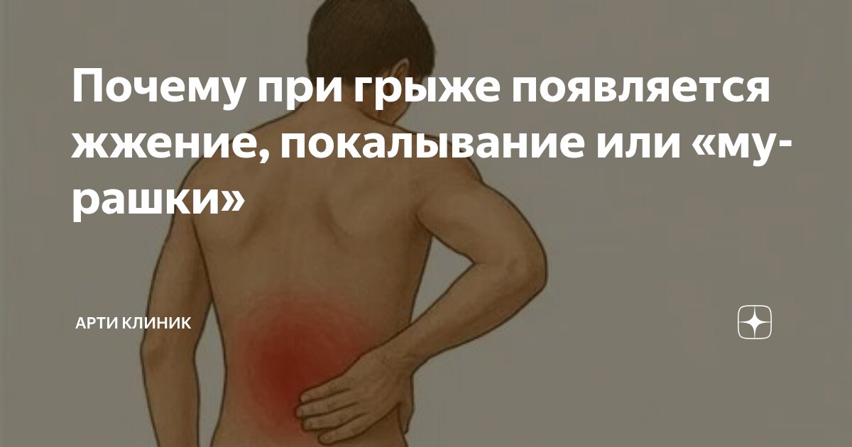 Почему при грыже появляется жжение, покалывание или «мурашки»