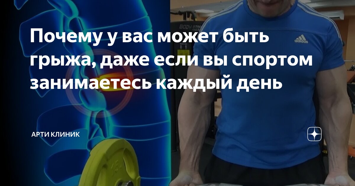 Почему у вас может быть грыжа, даже если вы спортом занимаетесь каждый день