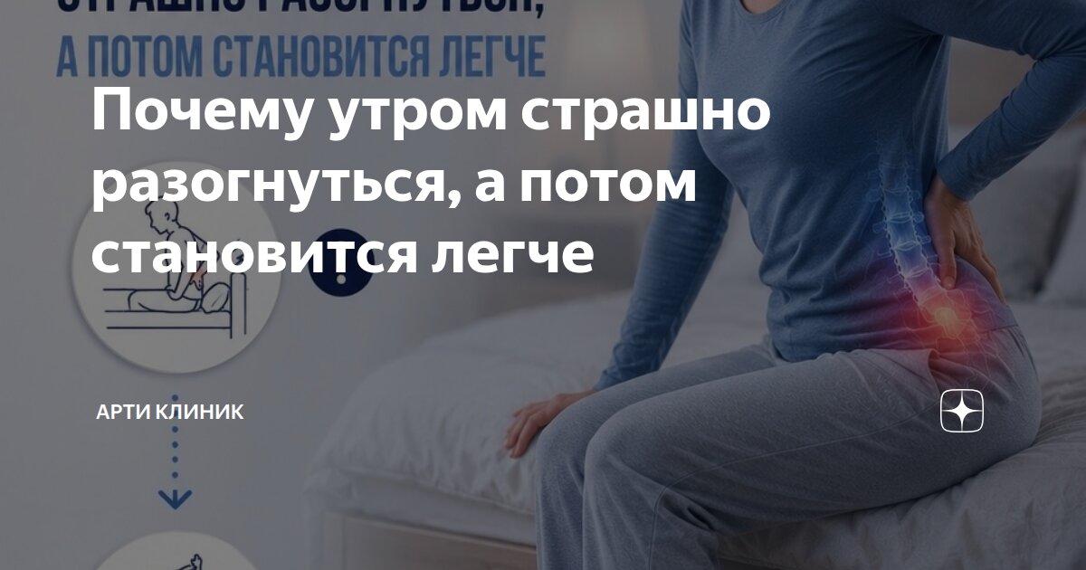 Почему утром страшно разогнуться, а потом становится легче