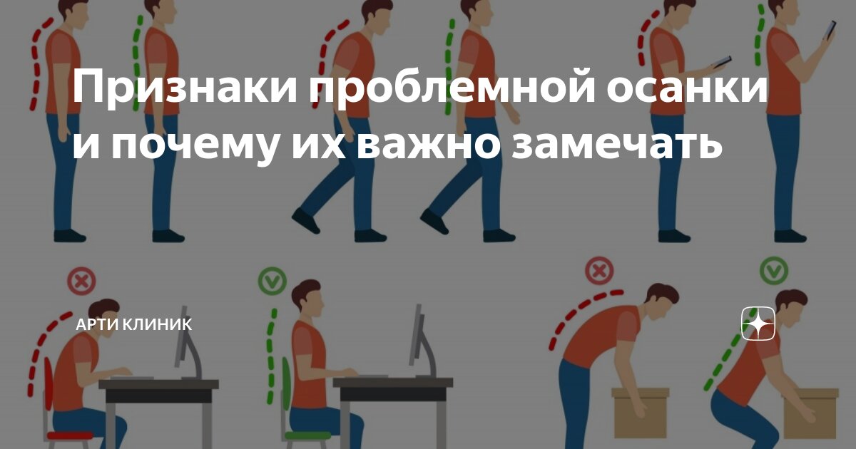 Признаки проблемной осанки и почему их важно замечать