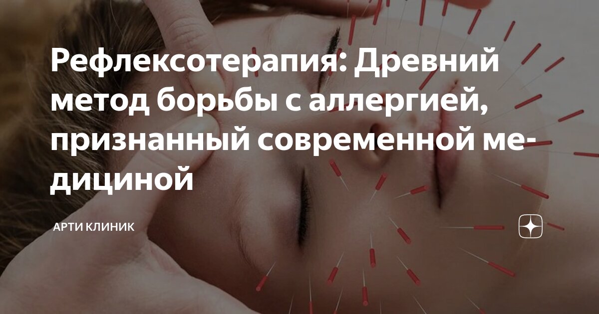 Рефлексотерапия: Древний метод борьбы с аллергией, признанный современной медициной