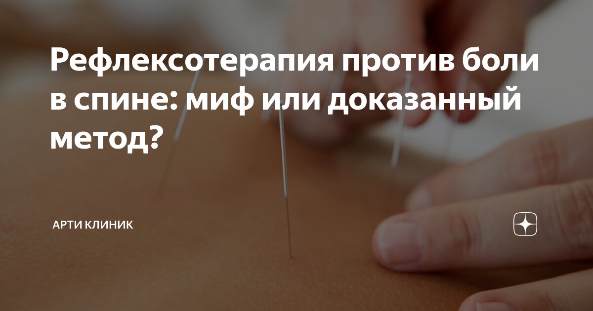 Рефлексотерапия против боли в спине: миф или доказанный метод?