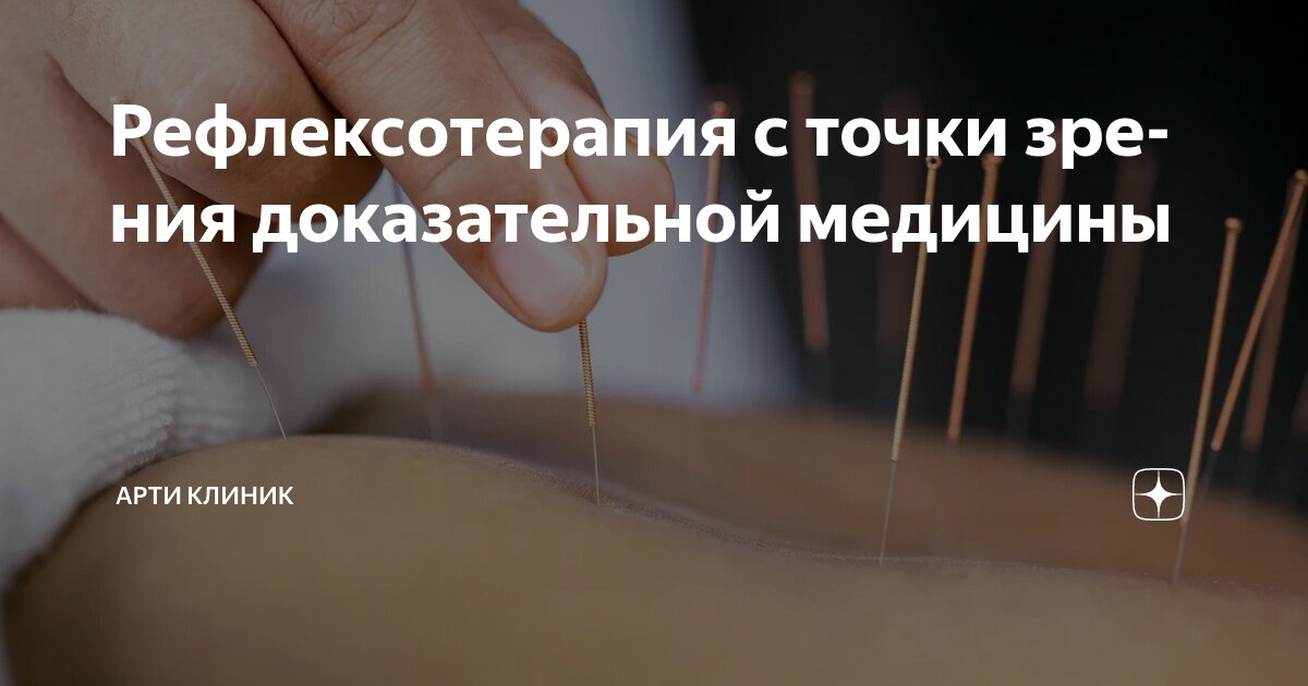 Рефлексотерапия с точки зрения доказательной медицины