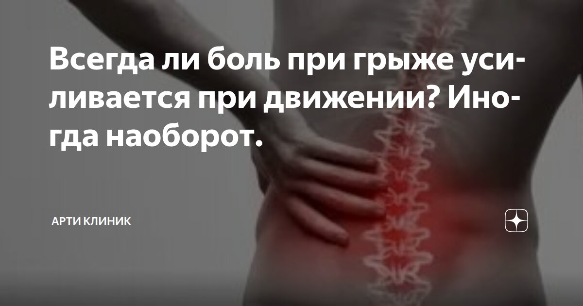 Всегда ли боль при грыже усиливается при движении? Иногда наоборот.