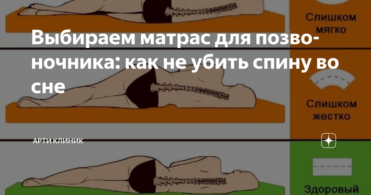 Выбираем матрас для позвоночника: как не убить спину во сне