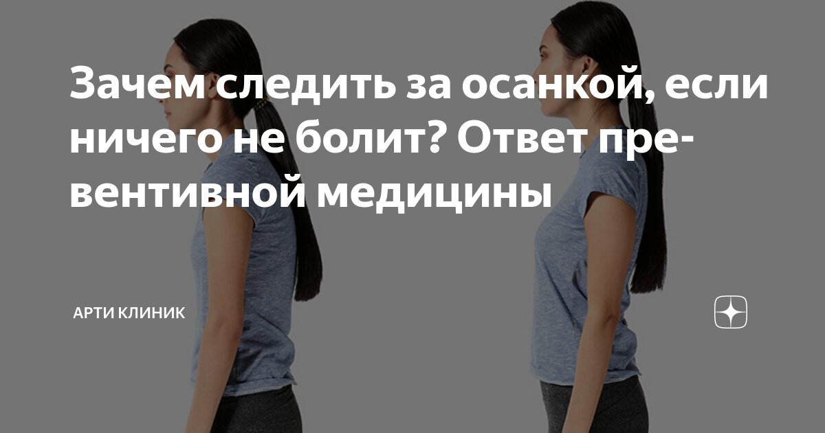 Зачем следить за осанкой, если ничего не болит? Ответ превентивной медицины
