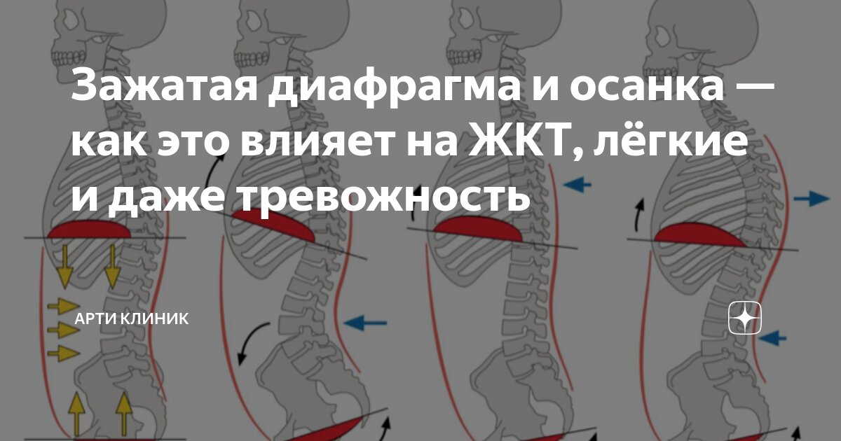 Зажатая диафрагма и осанка — как это влияет на ЖКТ, лёгкие и даже тревожность